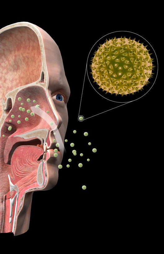 脸,头,脸颊,无人,竖图,室内,白天,正面,数码,科技,阴影,黑色背景,网络,高光,几何,计算机图形,合成,注视,黄色,观察,看,球体,观看,电脑合成图,数码合成图,察看,疾病,关注,哮喘,花粉,过敏,写实,具体,具象,顶骨,颧骨,花粉症,头部,脸部,脸蛋,面部,彩图,花粉粒