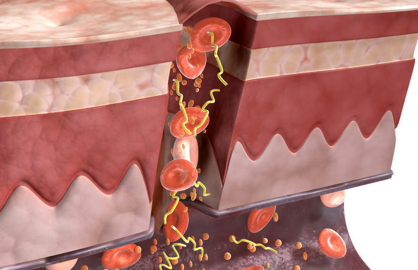 无人,横图,插画,室内,白天,白色背景,正面,数码,科技,静物,阴影,网络,结构,医学,细胞,高光,几何,计算机图形,构造,合成,图画,画,人体,皮肤,电脑合成图,数码合成图,伤口,生物学,血细胞,血小板,布局,横截面,漫画,生理学,写实,具体,具象,血块,纤维蛋白,彩图