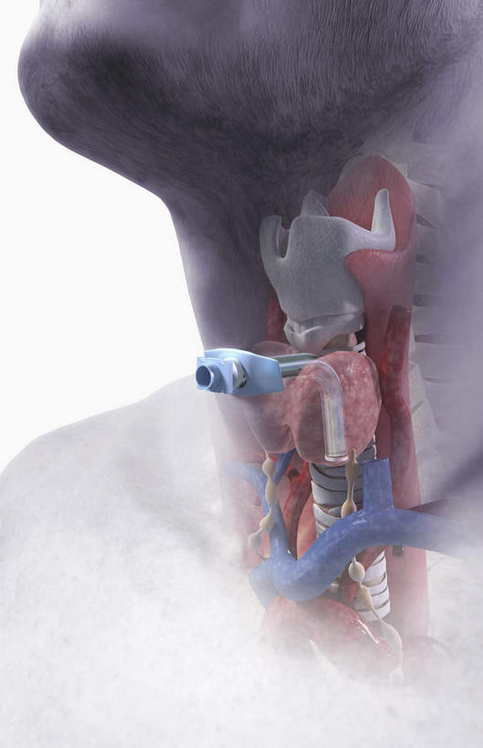 内脏,动脉,静脉,无人,竖图,室内,白天,白色背景,正面,数码,科技,静物,阴影,网络,医学,高光,几何,计算机图形,合成,模型,人体,电脑合成图,数码合成图,生物学,人体器官,器官,支气管,生理学,写实,具体,具象,彩图