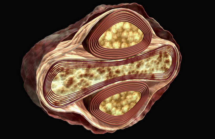 动脉,静脉,无人,横图,室内,白天,正面,数码,科技,微生物,静物,阴影,黑色背景,网络,医学,高光,几何,计算机图形,合成,模型,生物,人体,电脑合成图,数码合成图,医疗,病毒,生物学,生理学,写实,具体,具象,寄生,生命体,生物病毒,天花,彩图