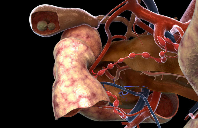 内脏,动脉,静脉,血管,无人,横图,插画,室内,特写,白天,正面,数码,科技,微生物,静物,阴影,黑色背景,网络,医学,细胞,高光,几何,计算机图形,合成,图画,画,红色,模型,生物,人体,电脑合成图,数码合成图,医疗,病毒,生物学,人体器官,器官,漫画,生理学,写实,具体,具象,胆结石,寄生,生命体,生物病毒,胆囊结石,彩图