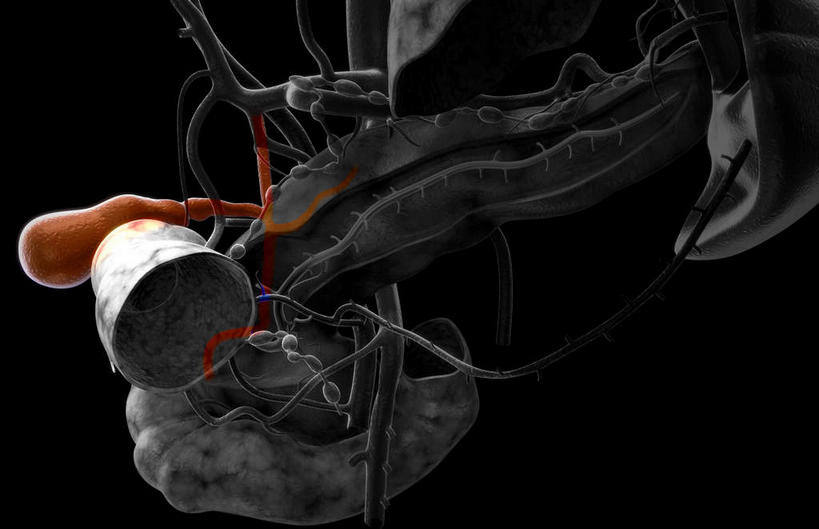 内脏,动脉,静脉,胆囊,无人,横图,插画,室内,特写,白天,正面,数码,科技,静物,阴影,黑色背景,网络,医学,光芒,高光,几何,计算机图形,合成,图画,画,模型,人体,电脑合成图,数码合成图,生物学,器官,漫画,生理学,写实,具体,具象,胆,彩图,消化系统