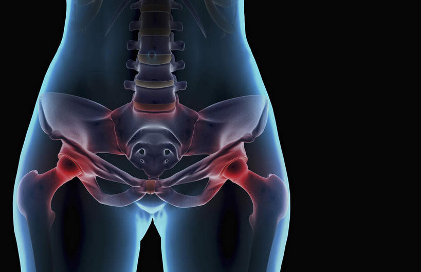 动脉,静脉,骨骼,无人,横图,插画,室内,特写,白天,正面,数码,科技,静物,阴影,黑色背景,局部,网络,医学,骨头,高光,几何,计算机图形,合成,图画,画,模型,人体,电脑合成图,数码合成图,骨架,生物学,漫画,生理学,写实,具体,具象,髋关节,半身,彩图