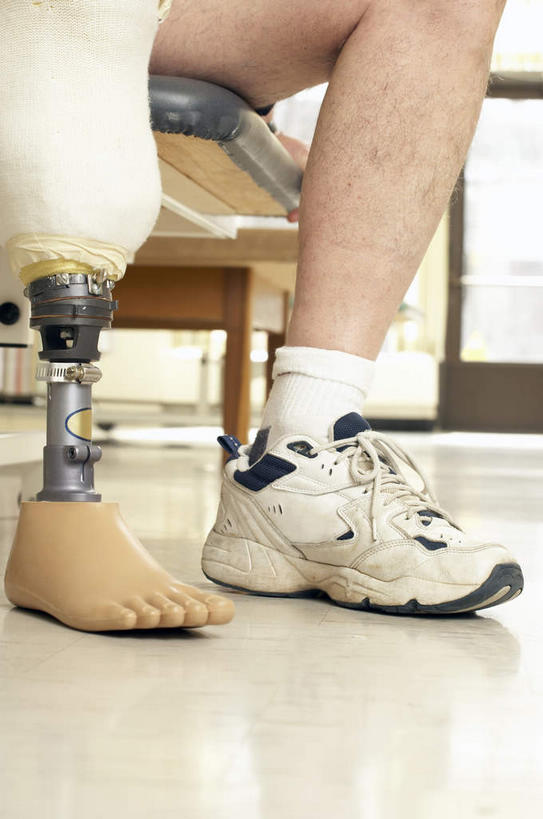 西方人,一个人,病人,医院,坐,竖图,室内,白天,仰视,运动鞋,鞋子,椅子,欧洲,欧洲人,仅一个男性,仅一个人,阴影,反射,瓷砖,地砖,工具,影子,走道,走廊,过道,地面,复健,仅一个老年男性,康复,器械,休闲鞋,医疗设备,病患,医疗器械,残疾,残疾人,医疗工具,假肢,义肢,伤残,医疗机构,辅助设备,残障,弱势群体,老年男性,男人,男性,白种人,患者,就医者,坐着,半身,彩图,低角度拍摄,病院,诊所