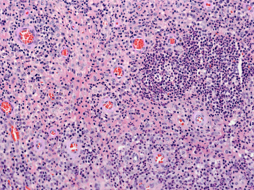无人,横图,俯视,室内,白天,仪器,微生物,一堆,许多,堆叠,堆积,检查,朦胧,模糊,反射,分析,科学,医学,细胞,显微镜,圆圈,很多,排列,蓝色,紫色,白色,观察,清晰,探索,摄影,放大,观看,堆,仔细,透镜,组织,生物学,血细胞,血小板,凸透镜,聚焦,关注,骨髓,光学,清楚,巨核细胞,解剖学,摆列,彩图,高角度拍摄,拍摄,布列,分列