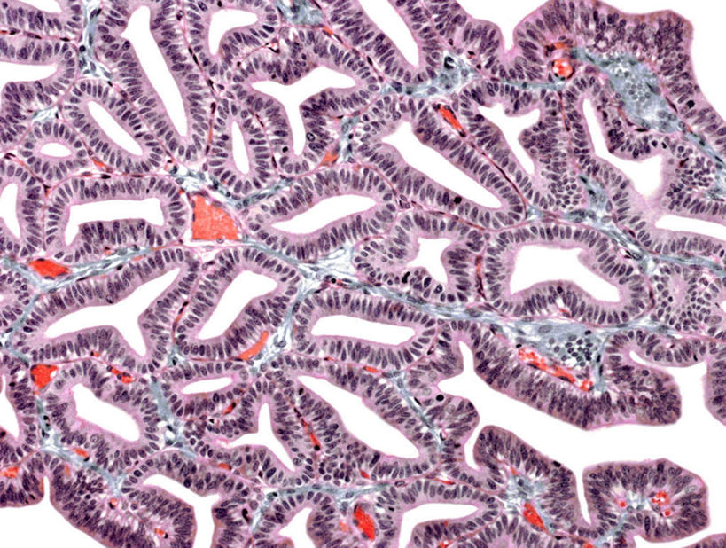 动脉,静脉,无人,横图,俯视,室内,特写,白天,仪器,微生物,许多,检查,反射,分析,科学,医学,显微镜,很多,排列,红色,紫色,白色,模型,观察,清晰,探索,摄影,放大,观看,仔细,分散,杂乱,散乱,透镜,组织,生物学,人体器官,混乱,凸透镜,聚焦,器官,繁殖,关注,输卵管,光学,清楚,摆列,女性生殖器官,上皮细胞,紊乱,芜杂,彩图,高角度拍摄,拍摄,布列,分列,上皮组织,生殖器官,蕃殖,繁生,孳生,滋生