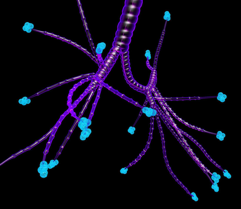 内脏,肺,动脉,静脉,无人,横图,插画,室内,白天,正面,数码,科技,许多,连接,阴影,黑色背景,组合,网络,很多,高光,几何,计算机图形,合成,图画,分开,画,球,蓝色,紫色,模型,分叉,链接,分散,电脑合成图,数码合成图,人体器官,紧固,器官,拼接,拼凑,漫画,支气管,医疗保健,写实,具体,具象,拼合,凑集,聚合,撮合,链结,牢固,支气管树,呼吸系统,肺部,肺脏,接触,彩图