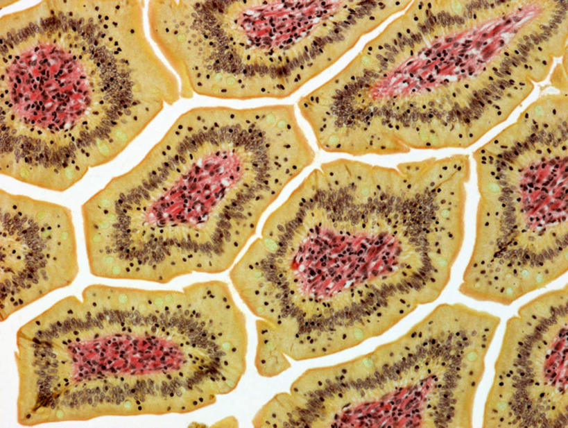 肠,十二指肠,无人,横图,俯视,室内,特写,白天,白色背景,仪器,盘绕,检查,朦胧,模糊,曲折,弯曲,环绕,围绕,反射,分离,分析,科学,医学,绒毛,显微镜,圈,褐色,分开,环抱,扩散,黄色,红色,包围,观察,清晰,探索,摄影,蜿蜒,缭绕,放大,观看,隔离,仔细,分散,透镜,生物学,凸透镜,聚焦,关注,分隔,分割,生理学,医疗保健,光学,清楚,涣散,疏散,朋分,支解,肠绒毛,大肠,盲肠,小肠,直肠,彩图,高角度拍摄,拍摄