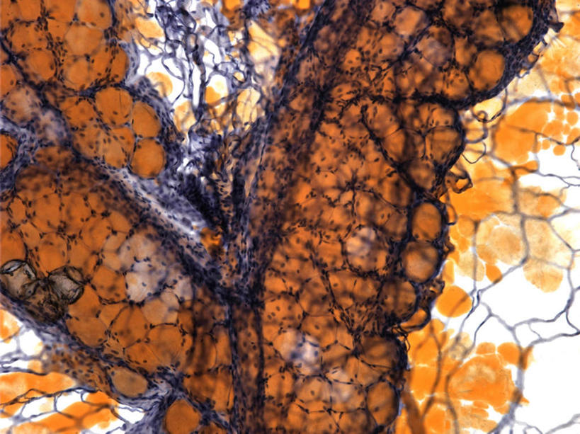 无人,横图,插画,室内,特写,白天,正面,数码,科技,静物,阴影,网络,医学,细胞,高光,几何,计算机图形,合成,图画,画,人体,电脑合成图,数码合成图,生物学,漫画,生理学,写实,具体,具象,脂肪细胞,脂肪组织,彩图