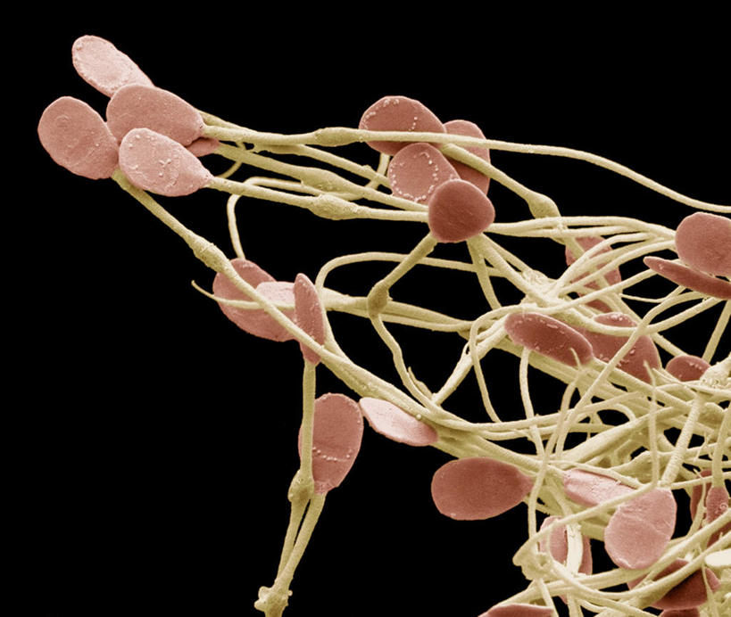 膀胱,睾丸,阴囊,尿道,无人,横图,插画,室内,特写,白天,正面,数码,科技,阴影,黑色背景,网络,高光,几何,计算机图形,合成,图画,画,红色,精子,电脑合成图,数码合成图,漫画,泌尿系统,前列腺,写实,具体,具象,附睾,内生殖器,排泄器官,外生殖器,输精管,精囊腺,尿道球腺,射精管,彩图,男性生殖系统,生殖器官