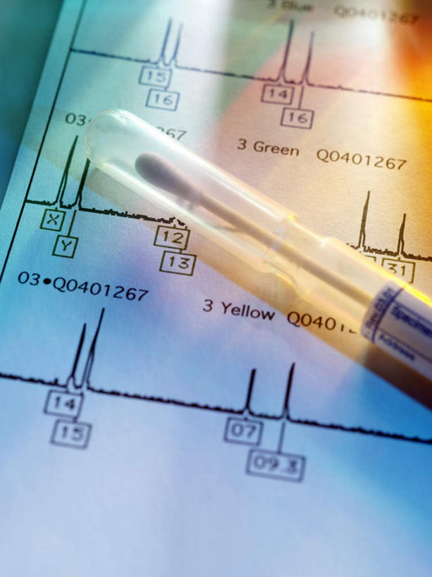 无人,竖图,俯视,室内,特写,白天,静物,一根,朦胧,模糊,曲折,科学,基因,英文,标志,数字,文字,线条,字符,字母,标识,棉签,生物,阿拉伯数字,盘曲,遗传,英文字母,脱氧核糖核酸,DNA分子,去氧核糖核酸,遗传信息,遗传因子,遗传学,波折,坎坷,崎岖,迂回,彩图,高角度拍摄