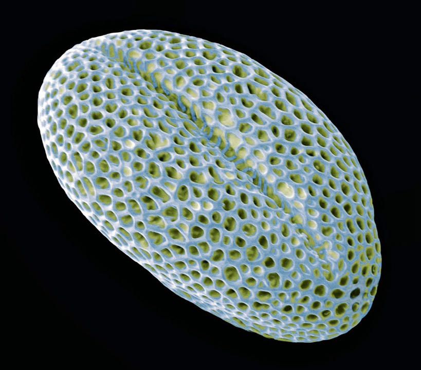 无人,横图,插画,室内,特写,白天,正面,数码,仪器,科技,阴影,黑色背景,检查,反射,分析,科学,网络,显微镜,高光,几何,计算机图形,合成,图画,画,绿色,油菜花,观察,清晰,探索,放大,观看,仔细,电脑合成图,数码合成图,透镜,凸透镜,聚焦,关注,漫画,花粉,写实,具体,具象,光学,清楚,电镜,彩图,芸苔,芸薹