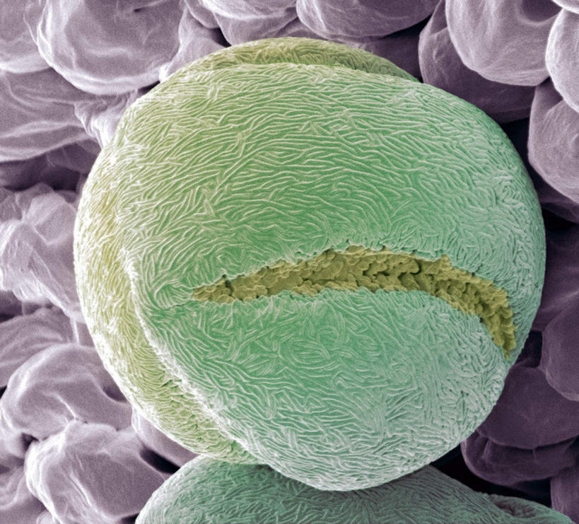 无人,横图,插画,室内,特写,白天,正面,数码,仪器,科技,草莓,浆果,阴影,检查,反射,分析,科学,网络,显微镜,高光,几何,计算机图形,合成,图画,画,绿色,观察,清晰,探索,放大,观看,仔细,电脑合成图,数码合成图,透镜,凸透镜,聚焦,关注,漫画,花粉,写实,具体,具象,光学,清楚,电镜,洋莓,水果皇后,红莓,地莓,彩图