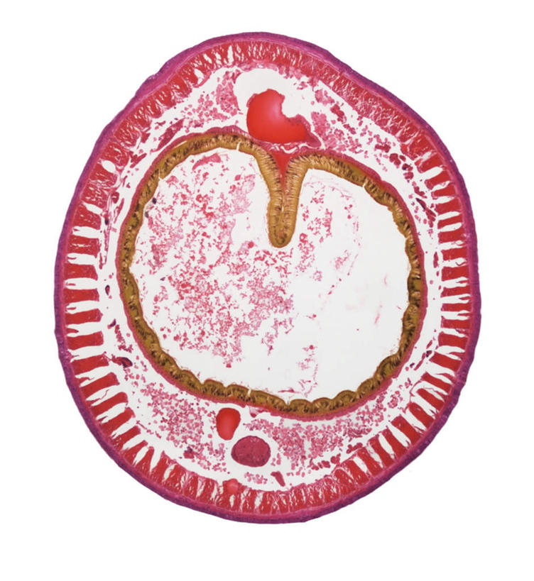 内脏,无人,竖图,室内,白天,白色背景,正面,兴奋,热情,静物,医学,圆形,开放,红色,模型,健康,温暖,奔放,活力,积极,激情,朝气,暖色,吉祥,生物学,生命,器官,饱满,蚯蚓,生理学,革命,肠道,热烈,赤色,充实,斗志,喜气,主动,彩图,欢乐