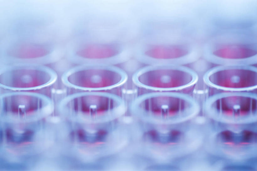 无人,横图,俯视,室内,特写,白天,实验,仪器,静物,杯子,一排,许多,绿色背景,朦胧,模糊,研究,整齐,透明,分析,化学,测试,试管,液体,塑料,洞,很多,架子,玻璃制品,排列,红色,玻璃瓶,瓶子,塑料制品,器皿,摄影,洞穴,影棚,样本,样品,队列,计量,穴,玻璃仪器,试验耗材,实验用品,玻璃杯,彩图,高角度拍摄,影棚拍摄,拍摄