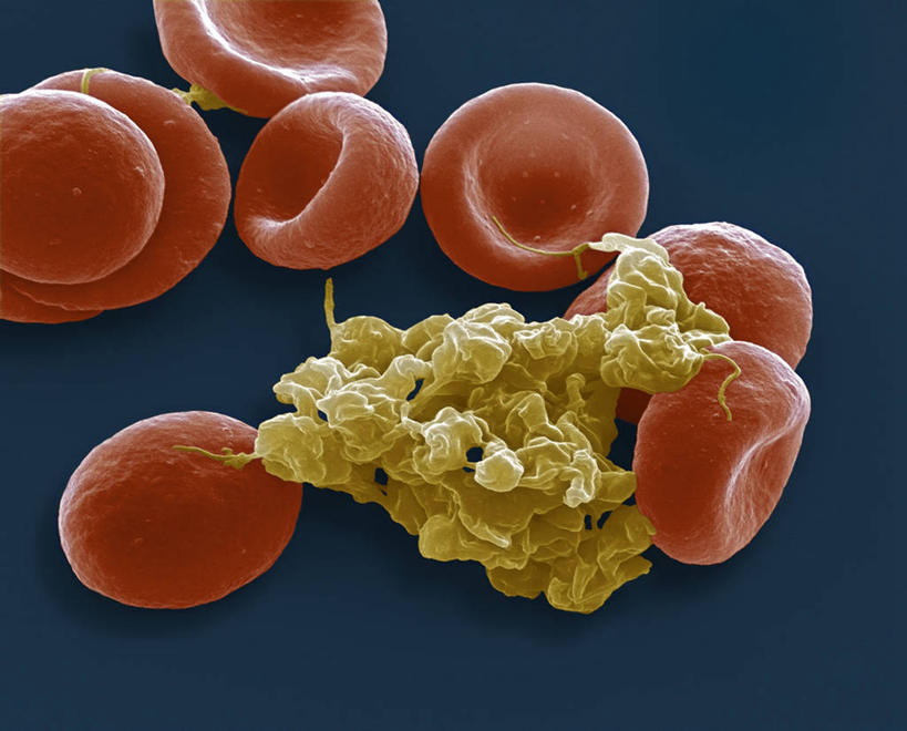 血管,毛细血管,无人,横图,x光片,室内,特写,白天,正面,微距,仪器,微生物,许多,蓝色背景,检查,反射,分析,辐射,科学,血球,医学,细胞,显微镜,很多,红色,观察,清晰,探索,放大,观看,仔细,透镜,医疗,生物学,科学技术,x射线,血细胞,凸透镜,聚焦,关注,x光,光学,清楚,显微图片,彩图,微距摄影,扫描电镜,扫描电子显微镜,电磁波,电磁辐射