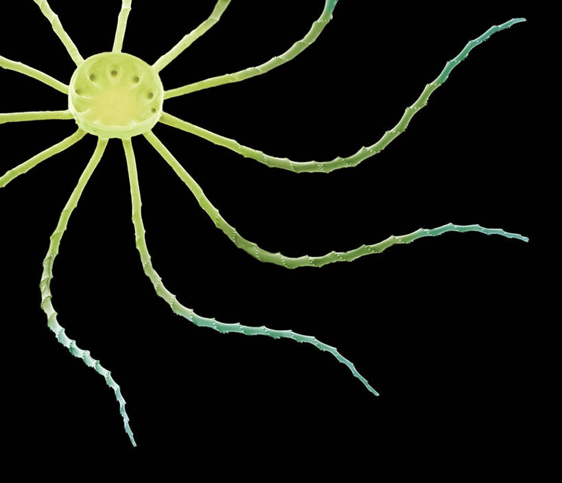 无人,横图,室内,特写,白天,正面,微距,仪器,植物,微生物,黑色背景,检查,反射,分析,科学,医学,细胞,显微镜,一个,黄色,绿色,自然,观察,清晰,探索,生长,放大,单个,成长,观看,仔细,透镜,生物学,凸透镜,聚焦,关注,光学,清楚,硅藻,显微图片,单细胞植物,彩图,微距摄影,扫描电镜,扫描电子显微镜