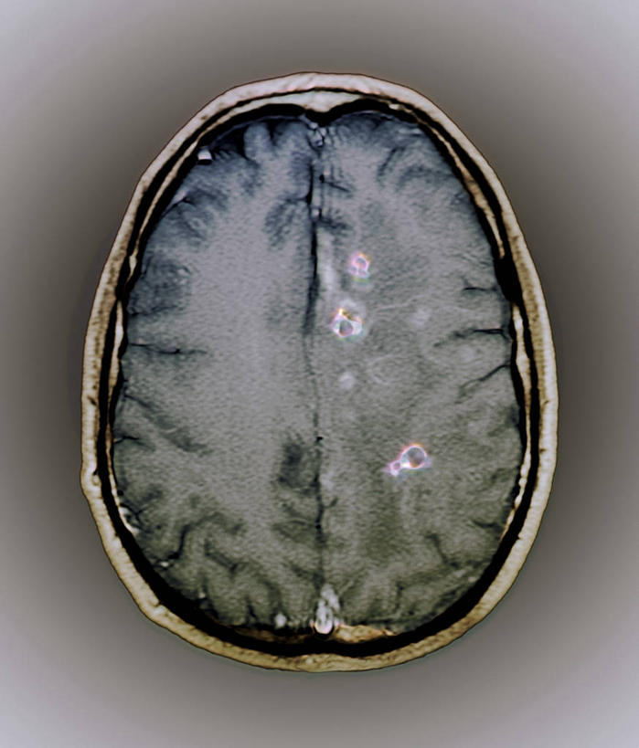 无人,竖图,室内,白天,正面,机器,大脑,灰色背景,医学,纹路,纹理,设备,扫描仪,医疗,医疗设备,器官,医疗器械,沟壑,核磁共振,横截面,医疗工具,剖面,核磁共振成像,小脑,脑干,肌理,核磁共振扫描仪,大脑皮层,端脑,沟,灰质,回,间脑,磁共振成像,核磁共振技术,检测工具,截面,截面图形,彩图