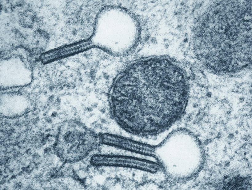 无人,横图,室内,特写,白天,正面,仪器,微生物,检查,反射,分析,科学,医学,纹路,纹理,细胞,显微镜,观察,清晰,探索,放大,观看,仔细,透镜,生物学,凸透镜,聚焦,关注,肌理,光学,清楚,显微图片,彩图,免疫细胞,透射电子显微镜,朗格汉斯细胞,免疫活性细胞