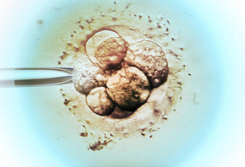 无人,横图,室内,特写,白天,正面,实验,仪器,科技,微生物,检查,研究,透明,反射,分析,科学,化学,医学,测试,滴管,细胞,显微镜,玻璃制品,观察,怀孕,米色,器皿,清晰,探索,放大,观看,仔细,透镜,医疗,生物学,科学技术,凸透镜,聚焦,关注,人工受精,计量,试管婴儿,玻璃仪器,试验耗材,实验用品,吸液管,光学,清楚,移液管,显微图片,彩图,体外受精,体外受孕