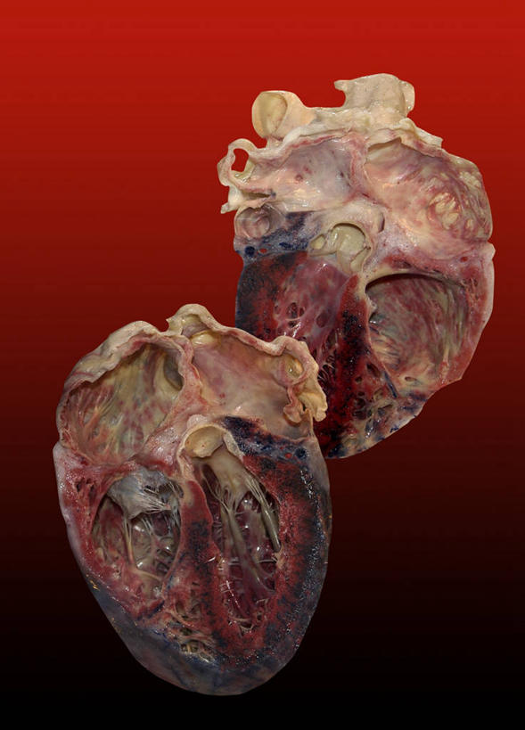 内脏,心脏,动脉,静脉,无人,竖图,室内,特写,白天,正面,阴影,红色背景,反射,科学,医学,影子,两个,人体,摄影,影棚,生物学,人体器官,器官,心血管,心房,心室,自然科学,博物学,生物科学,心,彩图,影棚拍摄,拍摄