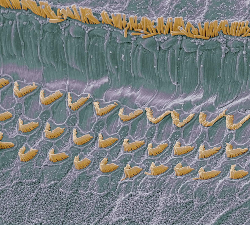 耳朵,无人,横图,插画,室内,白天,正面,数码,仪器,科技,阴影,检查,反射,分析,科学,网络,医学,显微镜,高光,几何,计算机图形,合成,图画,画,观察,清晰,探索,放大,观看,仔细,电脑合成图,数码合成图,透镜,生物学,人体器官,凸透镜,聚焦,器官,合成图,关注,漫画,耳廓,耳蜗,写实,具体,具象,光学,清楚,内耳,中耳,听觉器官,耳膜,外耳,耳道,显微图片,自然科学,博物学,生物科学,耳,耳部,彩图,扫描电镜,扫描电子显微镜