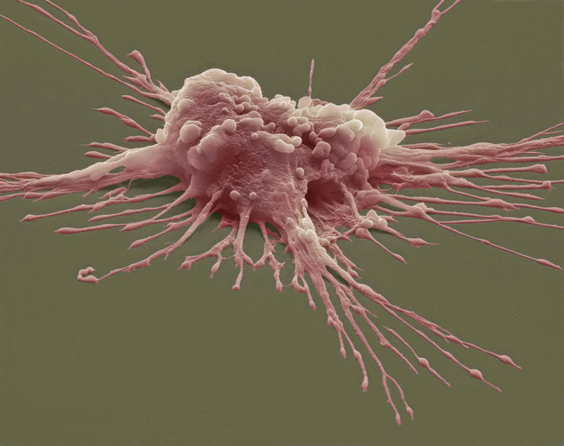 无人,横图,插画,室内,白天,正面,数码,仪器,科技,微生物,阴影,飞溅,检查,溅,反射,分析,科学,网络,医学,细胞,显微镜,液体,水滴,高光,几何,计算机图形,合成,图画,画,水珠,一个,红色,观察,清晰,探索,放大,褐色背景,单个,观看,仔细,电脑合成图,数码合成图,透镜,生物学,凸透镜,聚焦,合成图,关注,喷洒,漫画,写实,具体,具象,光学,清楚,多能干细胞,显微图片,彩图,扫描电镜,扫描电子显微镜,起源细胞,万用细胞,未分化细胞,干细胞