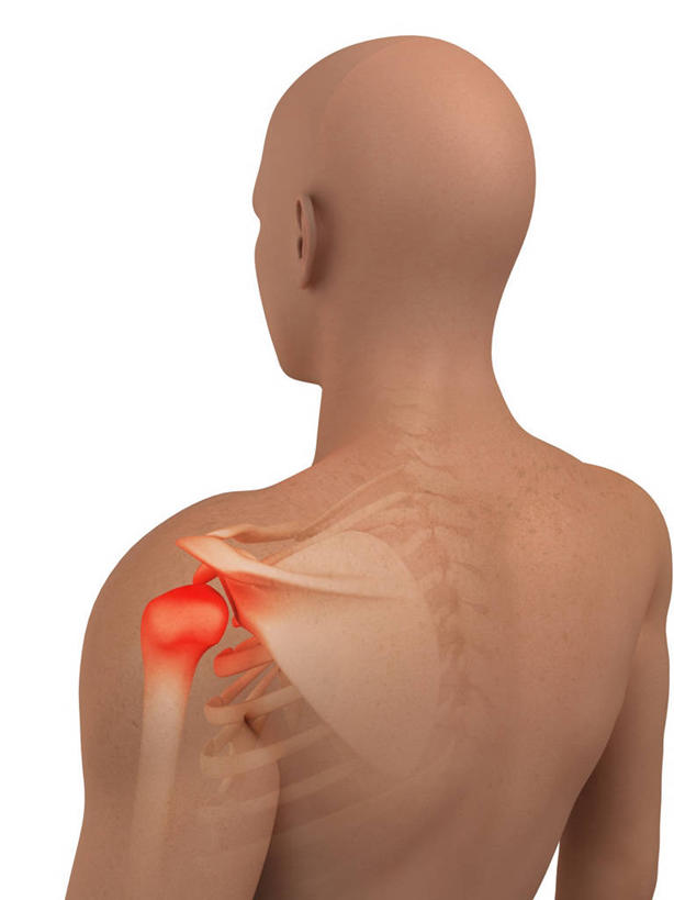 脊髓,骨骼,秃头,一个人,无人,站,竖图,插画,室内,白天,白色背景,正面,数码,科技,仅一个男性,仅一个人,阴影,网络,骨头,高光,几何,计算机图形,合成,图画,裸露,画,仅一个年轻男性,红色,站着,赤裸,电脑合成图,数码合成图,骨架,疾病,合成图,裸,漫画,写实,具体,具象,炎症,关节炎,男人,男性,年轻男性,脊柱,光头,无发,站立,半身,彩图,发炎,肩关节周围炎,肩周炎,凝肩,五十肩