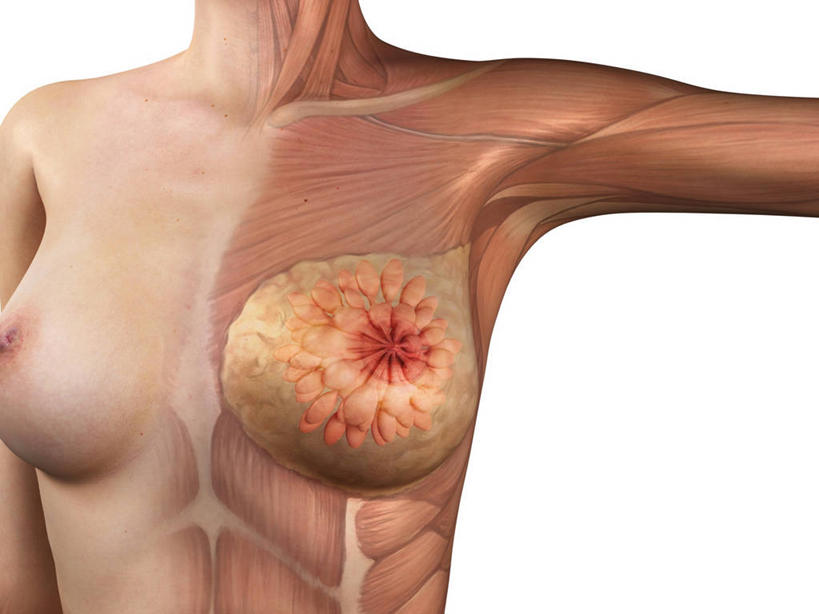 乳房,一个人,无人,站,举,横图,插画,室内,白天,白色背景,正面,数码,科技,微生物,仅一个年轻女性,仅一个女性,仅一个人,阴影,科学,网络,医学,细胞,高光,几何,计算机图形,合成,图画,裸露,画,托,站着,赤裸,电脑合成图,数码合成图,生物学,合成图,裸,漫画,写实,具体,具象,骨骼肌,年轻女性,女人,女性,举起,举手,举着,向上举,向上伸,向上托,站立,半身,彩图,肌肉细胞,肌细胞,横纹肌