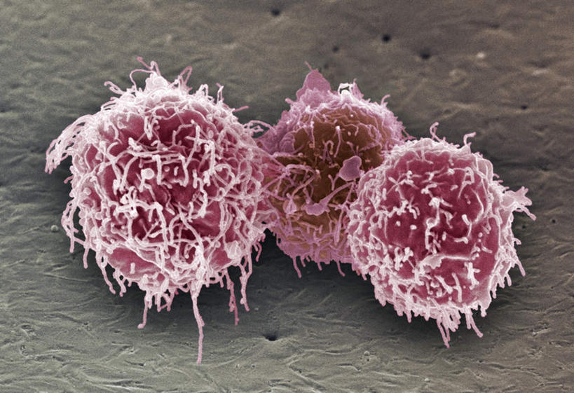 无人,横图,插画,室内,白天,正面,数码,科技,微生物,静物,阴影,网络,医学,高光,几何,计算机图形,合成,图画,画,三个,模型,人体,电脑合成图,数码合成图,生物学,漫画,癌症,生理学,写实,具体,具象,白血病,血癌,纤毛,彩图