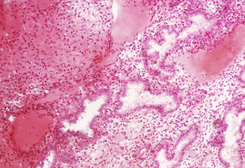 子宫,无人,横图,插画,室内,白天,正面,数码,科技,阴影,网络,高光,几何,计算机图形,合成,图画,画,红色,扫描,电脑合成图,数码合成图,显示,显现,漫画,写实,具体,具象,纤毛,微绒毛,内膜,表现,彩图