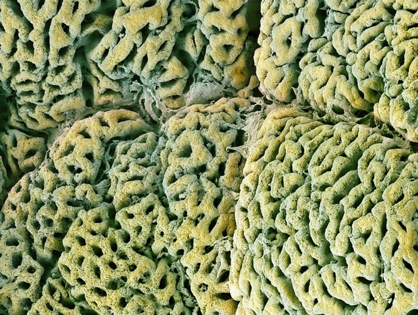 腹部,胃,无人,横图,室内,白天,正面,数码,科技,一排,许多,阴影,整齐,网络,细胞,洞,褐色,孔,很多,高光,几何,计算机图形,合成,排列,洞穴,电脑合成图,数码合成图,队列,穴,写实,具体,具象,胃壁,腹,肚子,胃部,彩图,消化系统