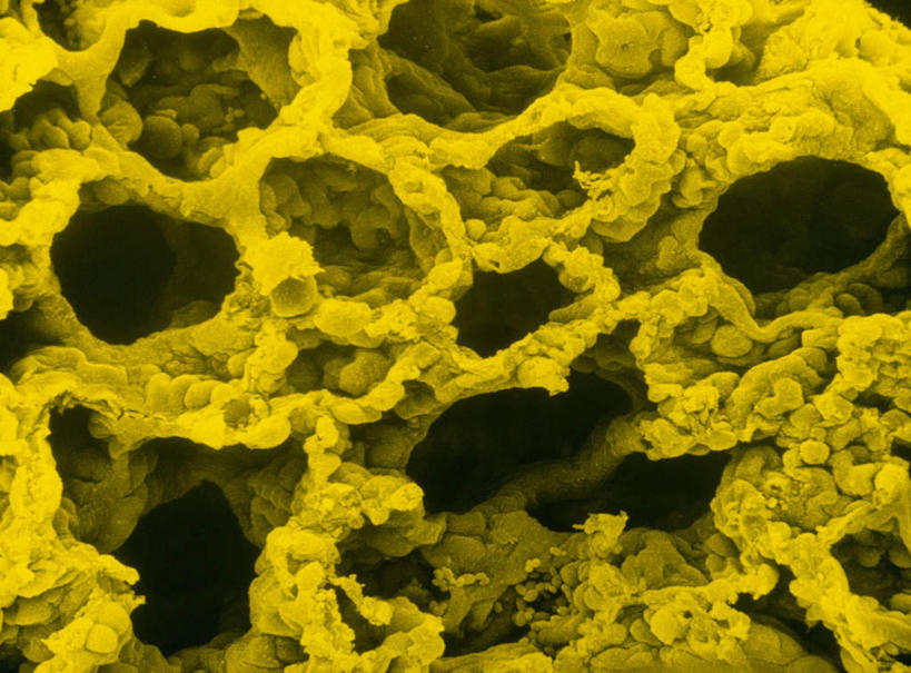 肺,无人,横图,室内,特写,白天,正面,数码,科技,一排,许多,阴影,整齐,网络,蜂窝,很多,高光,几何,计算机图形,合成,排列,黄色,电脑合成图,数码合成图,队列,软骨,写实,具体,具象,肺部,肺脏,彩图