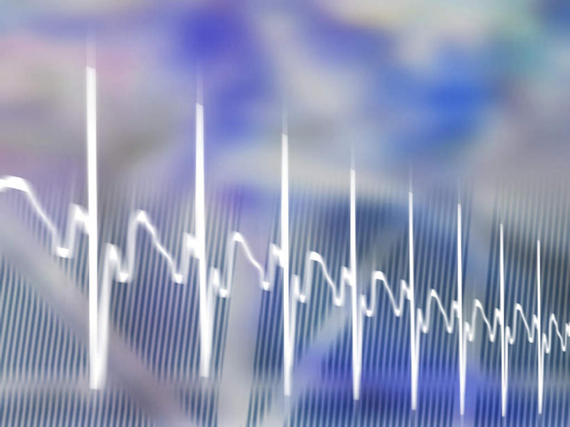 无人,横图,室内,白天,正面,数码,数据,科技,阴影,朦胧,模糊,分析,曲线,网络,心电图,高光,几何,计算机图形,合成,蓝色,保健,统计,电脑合成图,数码合成图,折线,医疗,医疗设备,折线图,写实,具体,具象,彩图