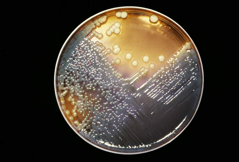 无人,横图,插画,室内,白天,正面,数码,实验,仪器,科技,微生物,阴影,黑色背景,研究,反射,分析,网络,化学,细菌,测试,圆形,培养皿,影子,圆,高光,几何,计算机图形,合成,图画,画,黄色,灰色,器皿,生物,电脑合成图,数码合成图,漫画,皮氏培养皿,试验耗材,实验用品,化学器材,医疗保健,写实,具体,具象,生命体,大肠杆菌,大肠埃希氏菌,肠道菌群,彩图