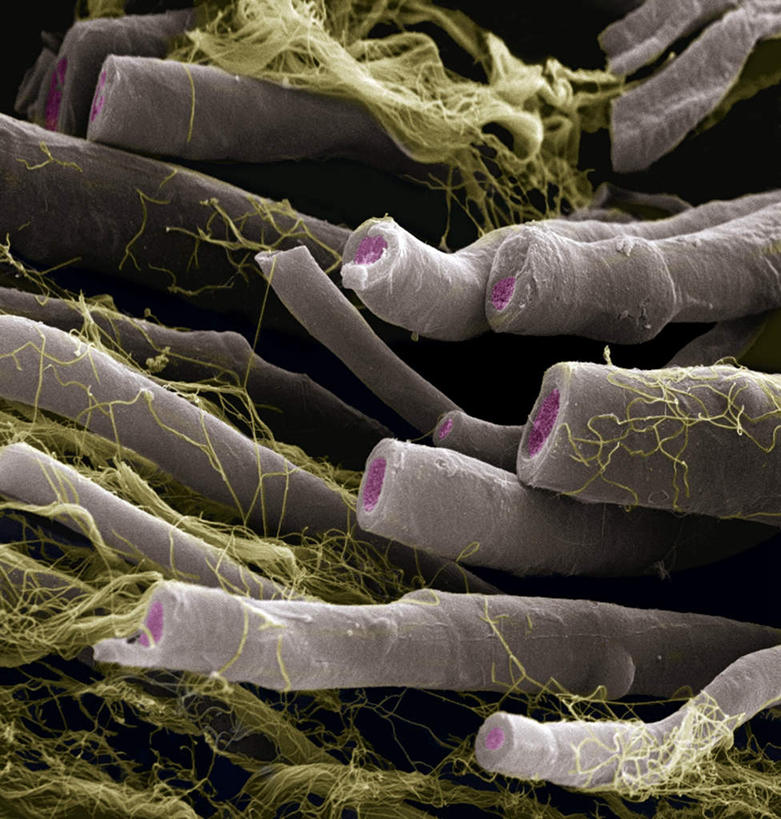 无人,竖图,室内,白天,正面,静物,医学,细胞,人体,纤维,生物学,生理学,神经细胞,髓质,髓鞘,彩图