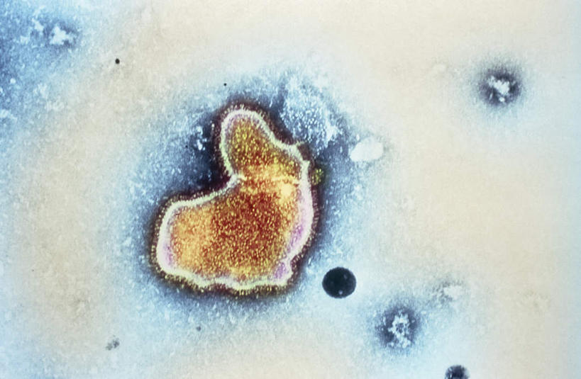 内脏,动脉,静脉,无人,横图,室内,白天,正面,静物,医学,模型,人体,疾病,生物学,人体器官,器官,生理学,肺炎,彩图