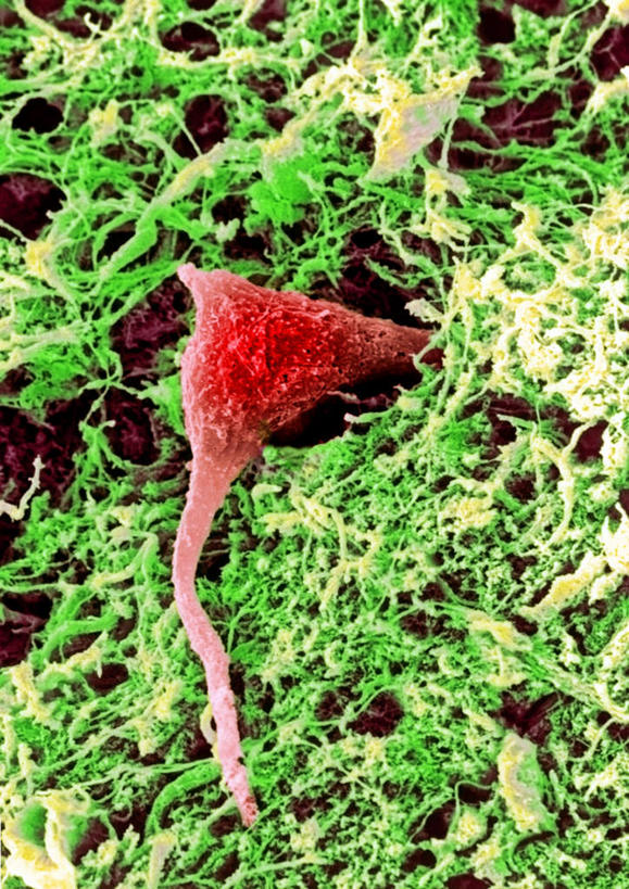 无人,竖图,俯视,室内,白天,微生物,科学,医学,细胞,生物,医疗,生物学,神经元,寄生,神经细胞,生命体,彩图,高角度拍摄