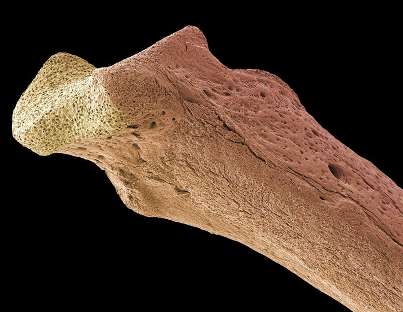 骨骼,无人,横图,室内,白天,正面,科技,一块,黑色背景,科学,医学,骨头,探索,创意,摄影,影棚,发现,骨架,疾病,人骨,探讨,创新,新意,骨质疏松,探究,探求,彩图,影棚拍摄,拍摄