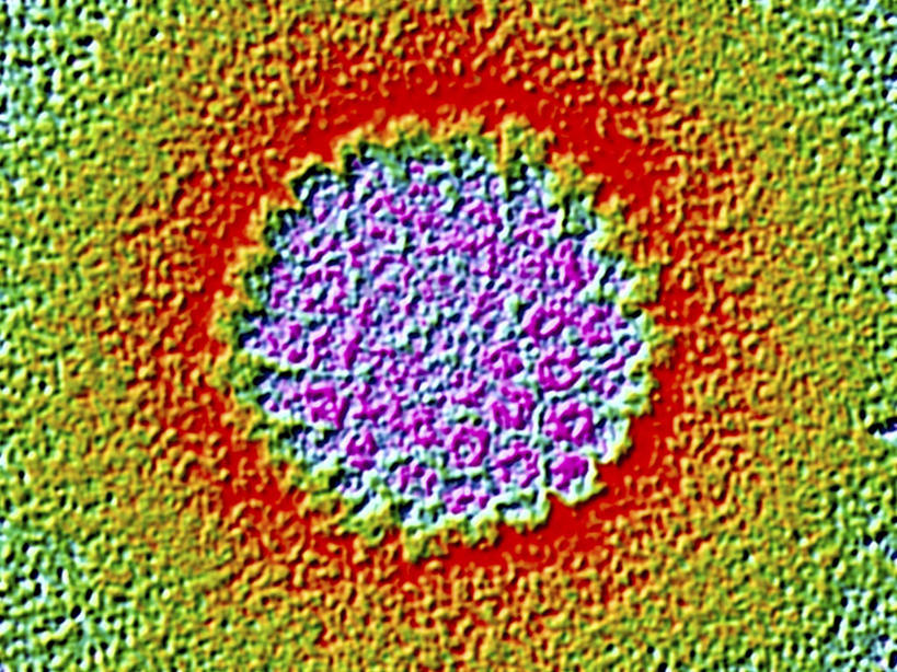 无人,横图,室内,特写,白天,白色背景,正面,数码,科技,微生物,阴影,网络,医学,圆形,高光,几何,计算机图形,合成,粉色,红色,绿色,生物,电脑合成图,数码合成图,医疗,病毒,生物学,写实,具体,具象,寄生,生命体,生物病毒,DNA病毒,疱疹,疱疹病毒,彩图