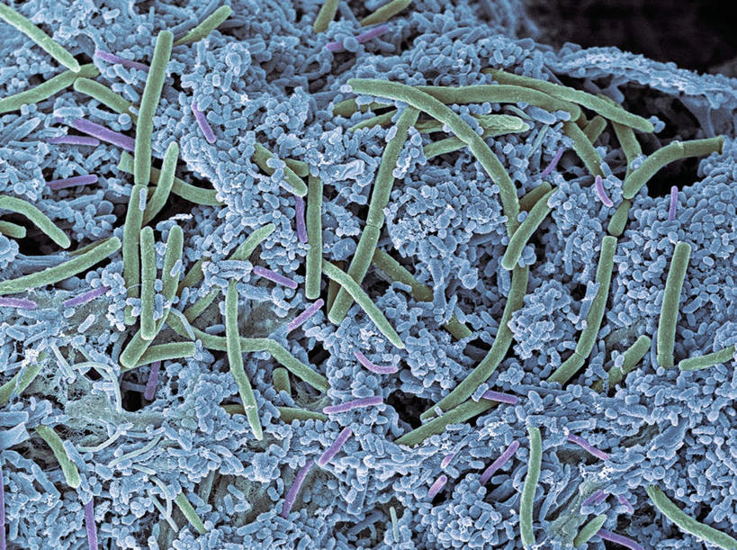 无人,横图,插画,室内,特写,白天,正面,数码,科技,阴影,黑色背景,网络,细菌,医学,高光,几何,计算机图形,合成,图画,画,腐烂,电脑合成图,数码合成图,生物学,漫画,生理学,写实,具体,具象,腐败,腐臭,腐朽,彩图,牙菌斑