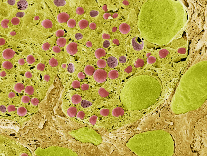 胰腺,无人,横图,插画,室内,特写,白天,正面,数码,科技,静物,阴影,网络,细胞核,血球,医学,细胞,高光,几何,计算机图形,合成,图画,画,红色,绿色,人体,电脑合成图,数码合成图,生物学,血细胞,漫画,生理学,写实,具体,具象,彩图,消化系统