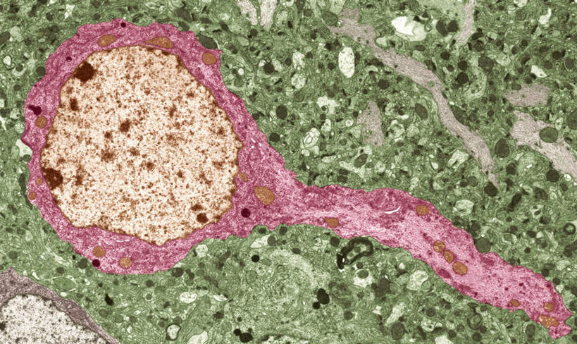 无人,横图,插画,室内,特写,白天,正面,数码,科技,静物,阴影,网络,细胞核,血球,医学,细胞,高光,几何,计算机图形,合成,图画,画,粉色,人体,电脑合成图,数码合成图,生物学,血细胞,横截面,漫画,生理学,写实,具体,具象,神经细胞,中枢神经系统,彩图