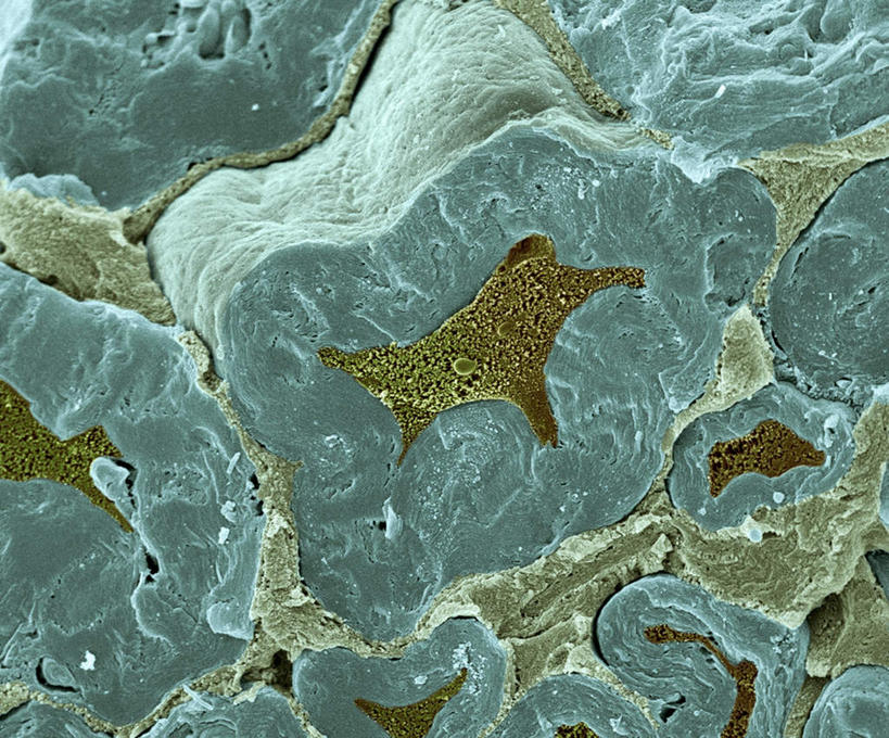 无人,横图,插画,室内,特写,白天,正面,数码,科技,静物,阴影,网络,血球,医学,细胞,高光,几何,计算机图形,合成,图画,画,蓝色,人体,电脑合成图,数码合成图,生物学,血细胞,横截面,漫画,生理学,写实,具体,具象,神经细胞,中枢神经系统,彩图