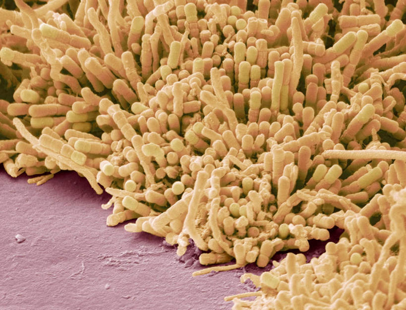 嘴,无人,横图,室内,白天,正面,数码,科技,一堆,连接,阴影,堆叠,堆积,组合,网络,细胞,高光,几何,计算机图形,合成,黄色,生物,堆,链接,电脑合成图,数码合成图,生物学,拼接,拼凑,写实,具体,具象,拼合,凑集,聚合,撮合,链结,链球菌,变形链球菌,口,口腔,嘴巴,嘴唇,彩图