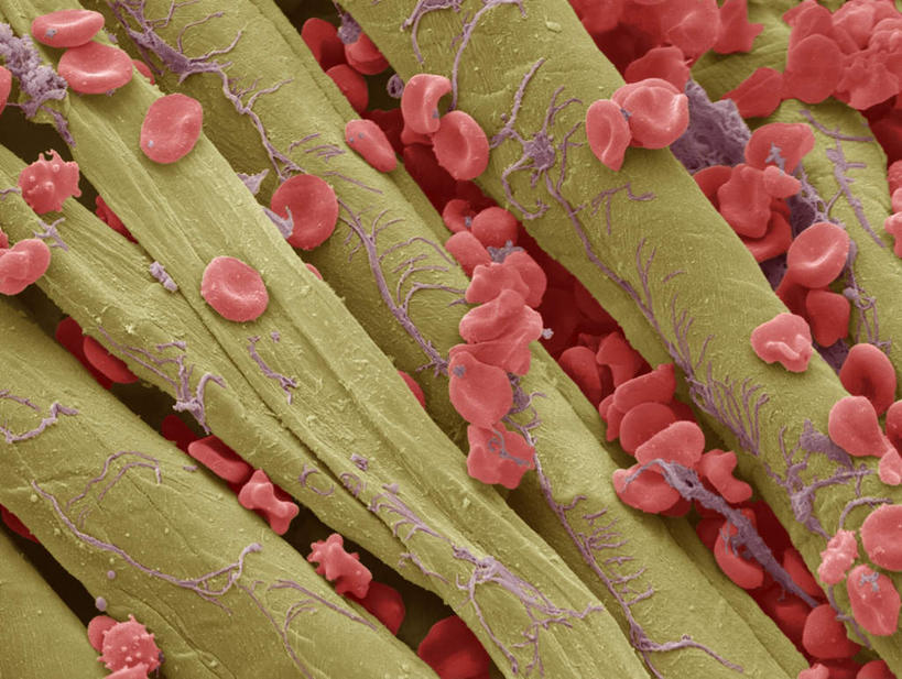 嘴,无人,横图,室内,特写,白天,正面,数码,科技,一堆,连接,阴影,堆叠,堆积,组合,网络,细胞,高光,几何,计算机图形,合成,红色,生物,堆,链接,电脑合成图,数码合成图,生物学,拼接,拼凑,写实,具体,具象,拼合,凑集,聚合,撮合,链结,链球菌,变形链球菌,口,口腔,嘴巴,嘴唇,彩图