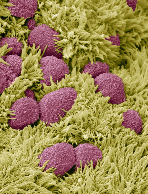 动脉,静脉,无人,竖图,室内,特写,白天,正面,数码,科技,静物,一堆,阴影,堆叠,堆积,网络,医学,细胞,高光,几何,计算机图形,合成,模型,人体,堆,电脑合成图,数码合成图,生物学,人体器官,器官,输卵管,生理学,写实,具体,具象,纤毛,彩图,生殖器官