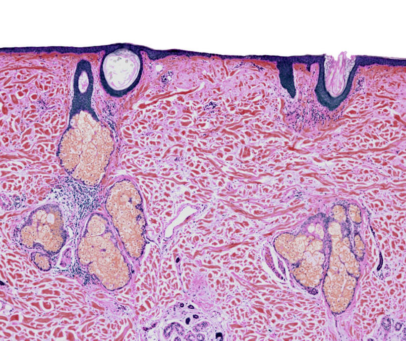 无人,横图,插画,室内,特写,白天,正面,数码,科技,静物,阴影,网络,医学,细胞,高光,几何,计算机图形,合成,图画,画,紫色,人体,电脑合成图,数码合成图,生物学,漫画,生理学,写实,具体,具象,头皮,彩图