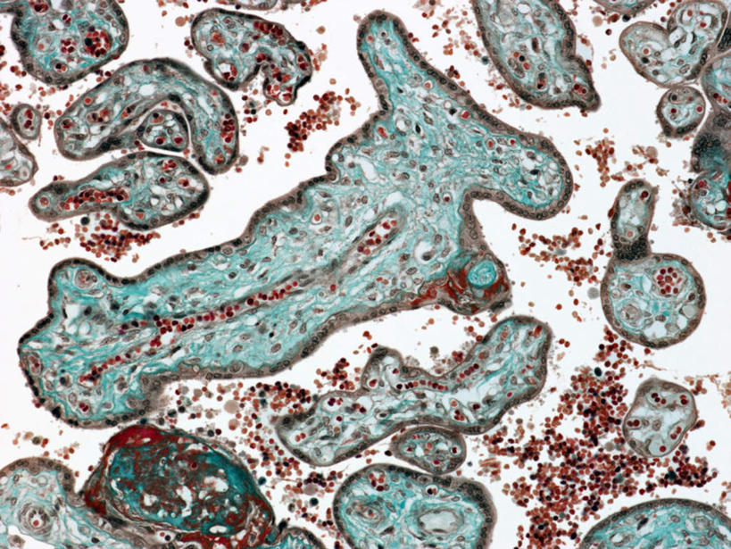 无人,横图,插画,室内,特写,白天,白色背景,正面,数码,科技,阴影,网络,高光,几何,计算机图形,合成,图画,画,生物,电脑合成图,数码合成图,生物学,漫画,胎盘,写实,具体,具象,彩图