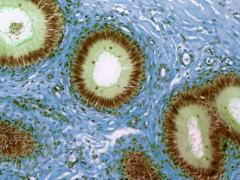 膀胱,睾丸,阴囊,尿道,无人,横图,插画,室内,特写,白天,正面,数码,科技,阴影,网络,高光,几何,计算机图形,合成,图画,画,电脑合成图,数码合成图,漫画,泌尿系统,前列腺,写实,具体,具象,附睾,内生殖器,排泄器官,外生殖器,输精管,精囊腺,尿道球腺,射精管,彩图,男性生殖系统,生殖器官